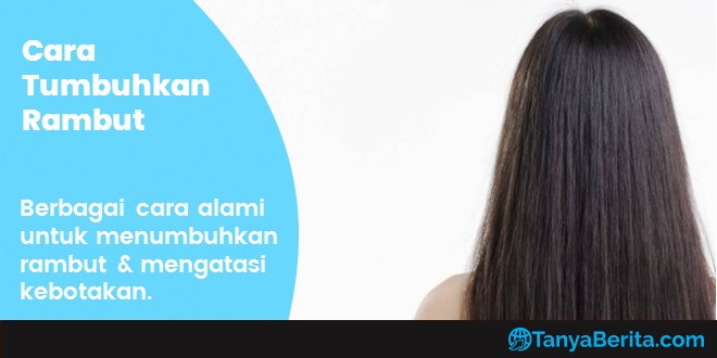 Rambut Rontok? Jangan Panik! Solusi Mengatasi Kebotakan pada Wanita