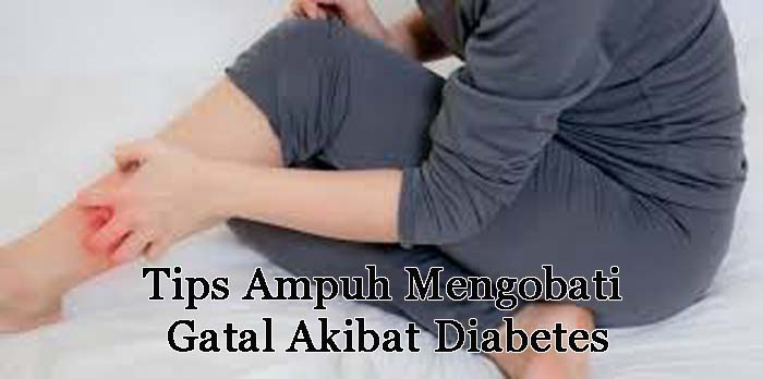 Mengatasi Kebotakan Akibat Diabetes: Panduan Lengkap untuk Mengembalikan Rambut Anda