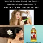 Rambut Rontok? Bisa Jadi Kekurangan Vitamin! Solusi Lengkap Atasi Masalahmu