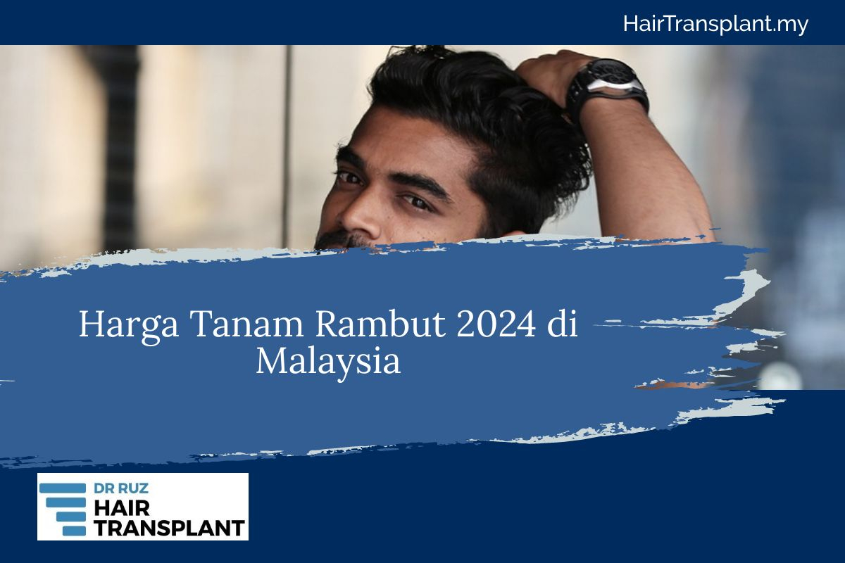 Harga Tanam Rambut: Berapa Biaya yang Harus Dikeluarkan untuk Prosedur Ini?