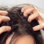 Rambut Tipis? Mungkin Asupan Nutrisi Anda Kurang!