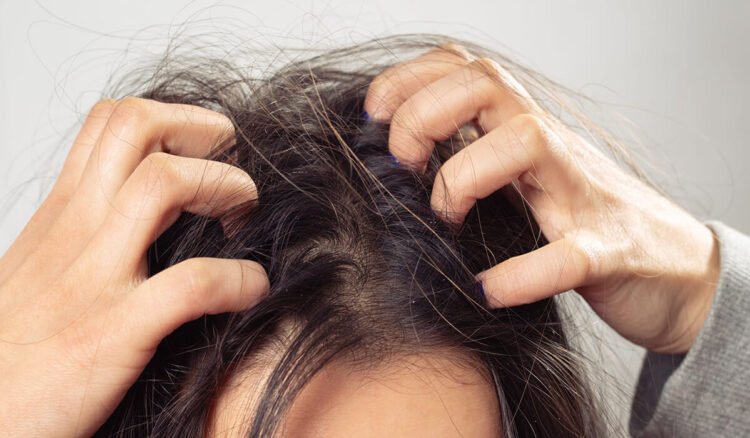 Rambut Tipis? Mungkin Asupan Nutrisi Anda Kurang!