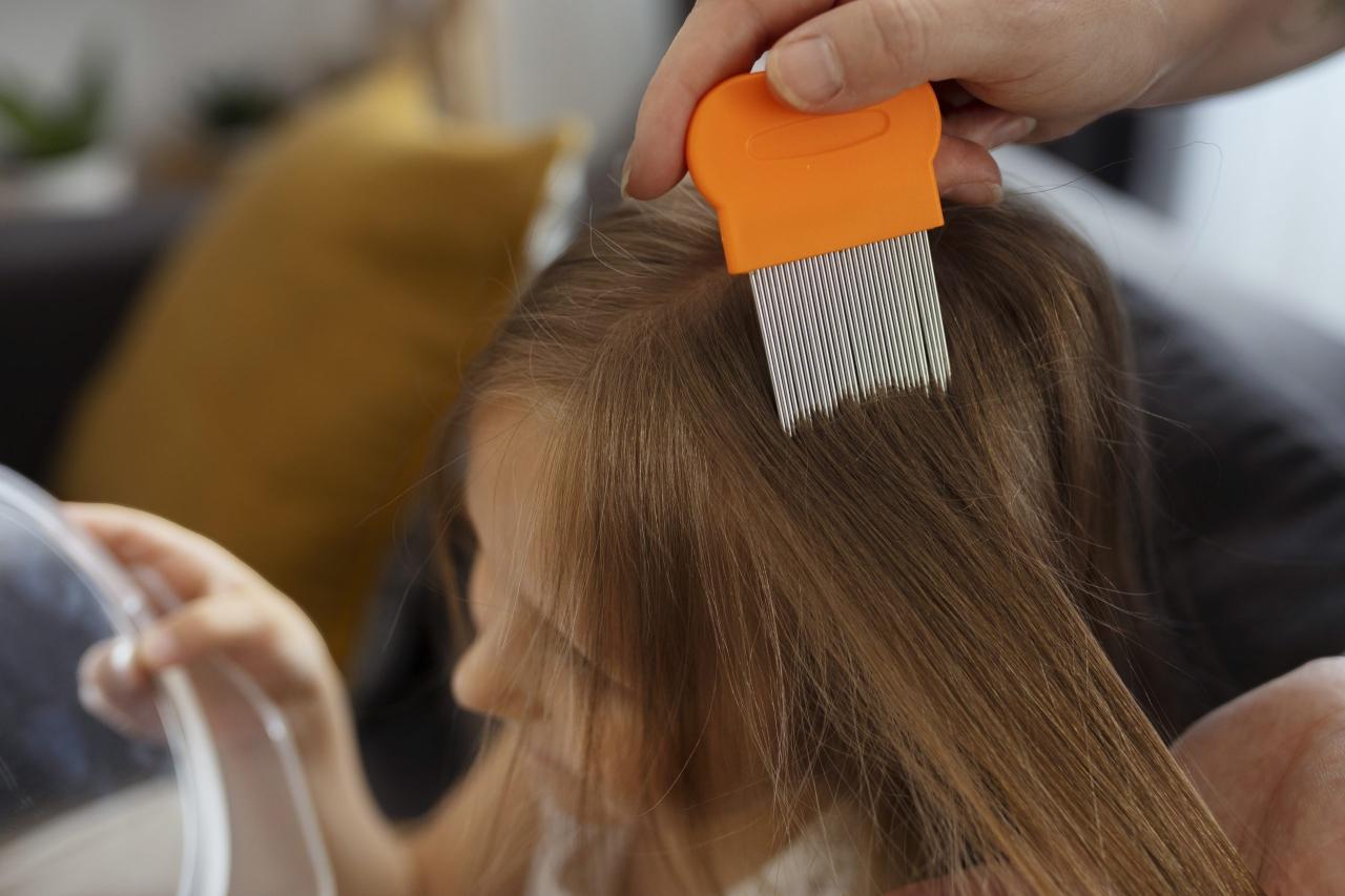 Kutu Rambut: Si Penghuni Tak Diundang yang Mengganggu