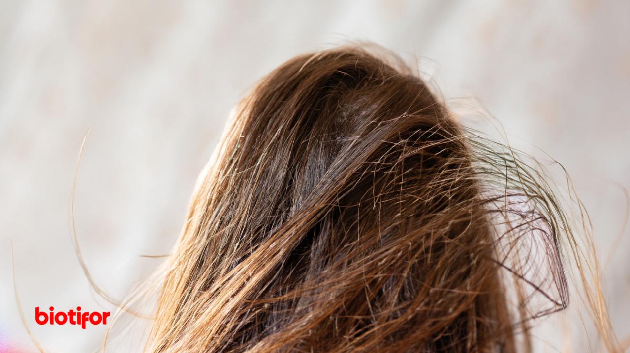 Apakah Rambut Kering Bisa Dikembalikan Sehat? Rahasia Menuju Rambut Lembut dan Berkilau