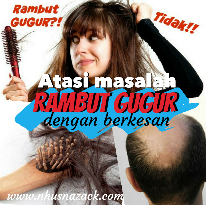 Rambut Rontok Bikin Stres? Tenang, Atasi dengan Cara Ini!