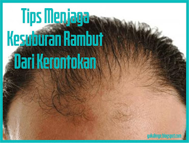 Rambut Rontok? Jangan Panik! Solusi Mengatasi Kebotakan pada Wanita