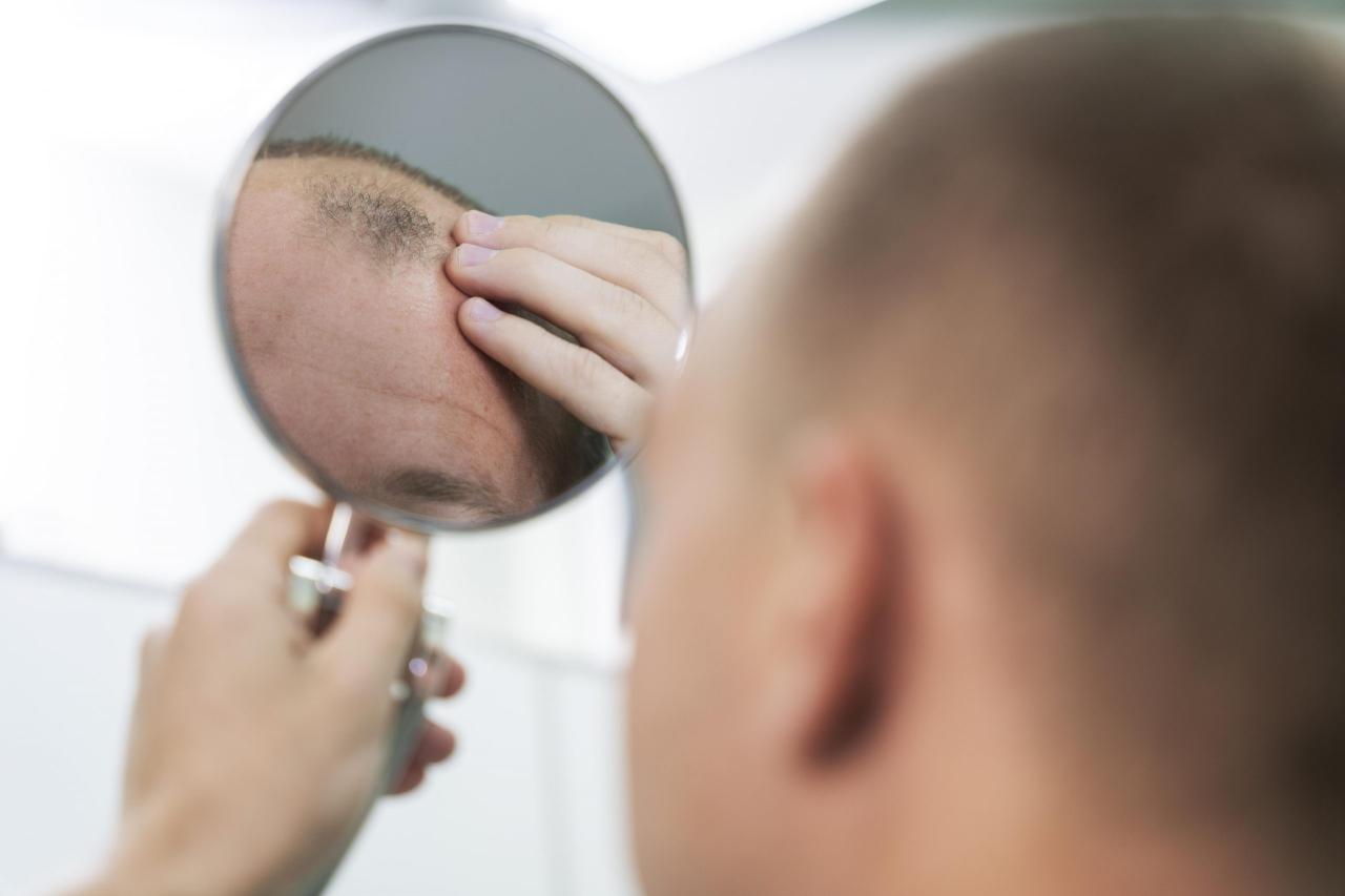 Lebih dari Sekedar Genetika: Penyebab Rambut Rontok Pada Pria yang Sering Diabaikan