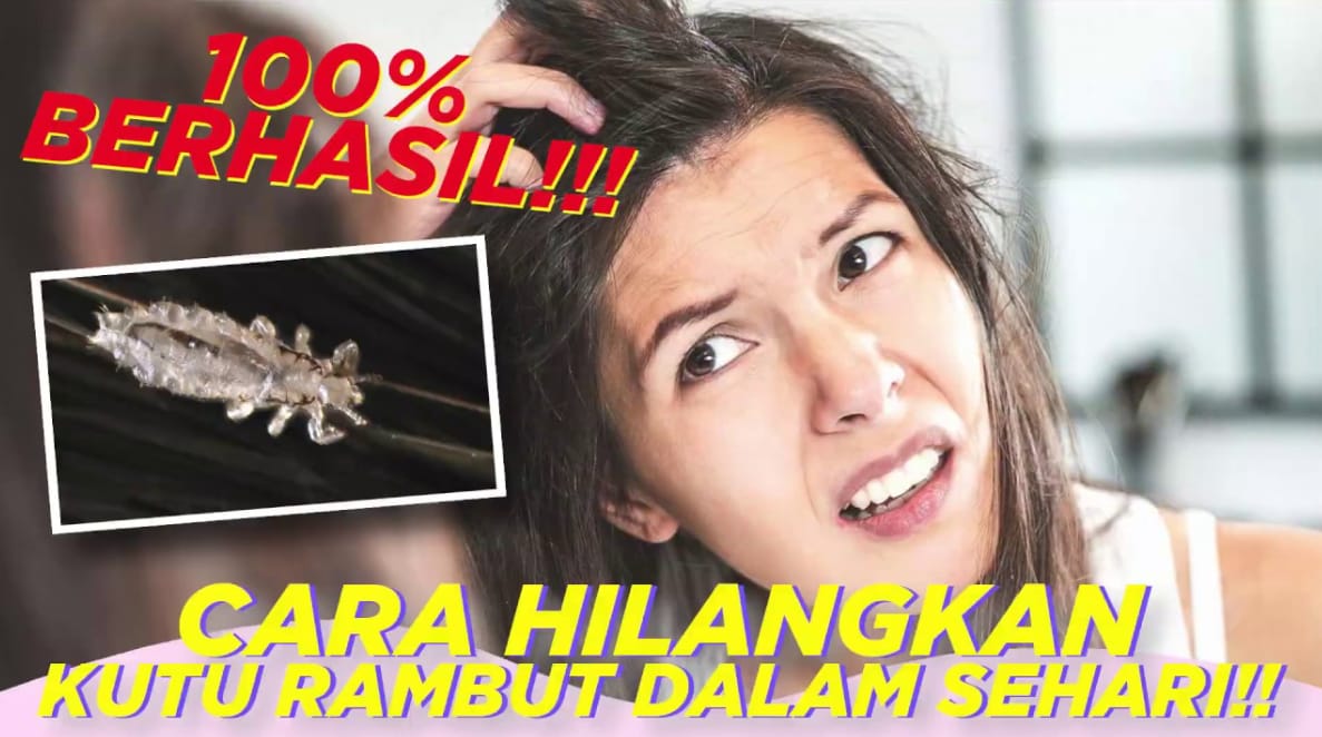 Mengusir Kutu Rambut dengan Minyak Kayu Putih: Benarkah Efektif?