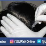 Rambut Rontok Bikin Stres? Tenang, Ini 7 Tips Merawat Rambut Wanita Agar Tetap Sehat dan Lebat!