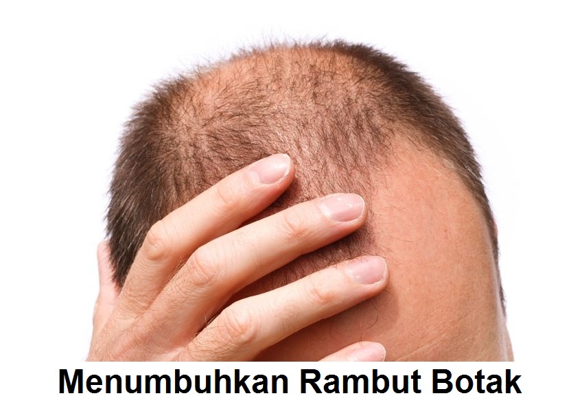 Rambut Botak Licin: Bisakah Kembali Tumbuh?