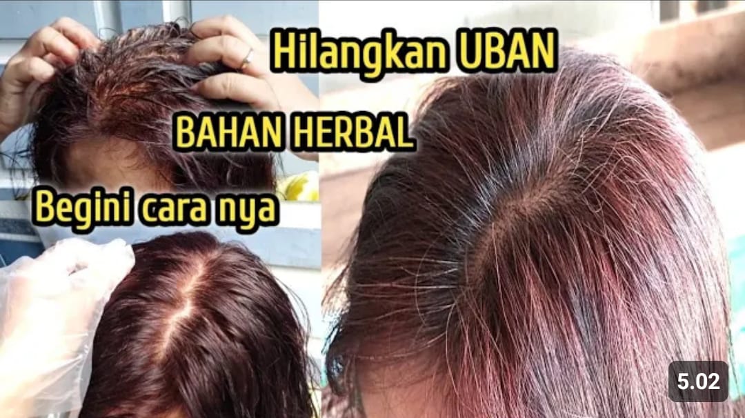 Merindukan Rambut Hitam Legam? Coba Metode Alami dan Produk Ini!