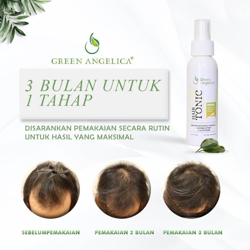 Rahasia Rambut Sehat dan Lebat: Atasi Rambut Rontok dengan Perawatan Herbal