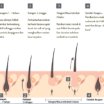 Rambut Kering dan Rontok? Ini Nutrisi yang Dibutuhkan!