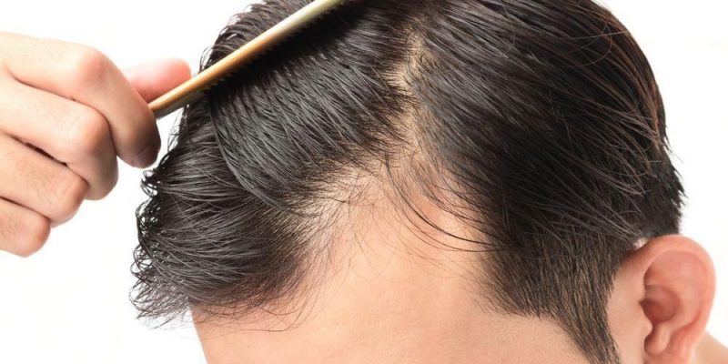 Rambut Rontok Pasca Menopause? Atasi dengan Nutrisi yang Tepat!