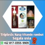 Rambut Tipis? Jangan Panik! Atasi dengan Vitamin Rambut dan Kembalikan Kepercayaan Dirimu