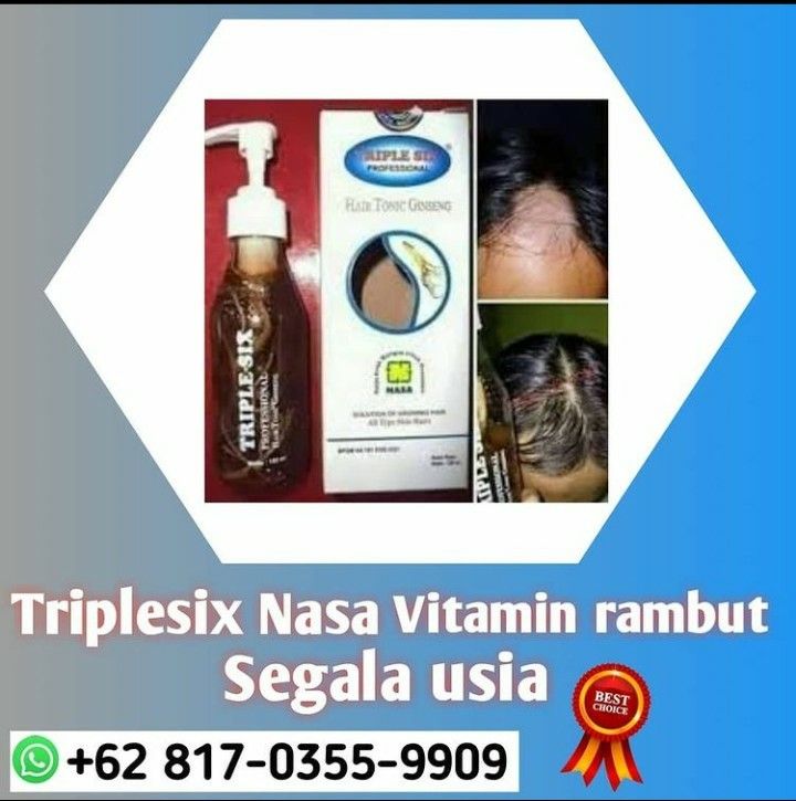 Rambut Tipis? Jangan Panik! Atasi dengan Vitamin Rambut dan Kembalikan Kepercayaan Dirimu