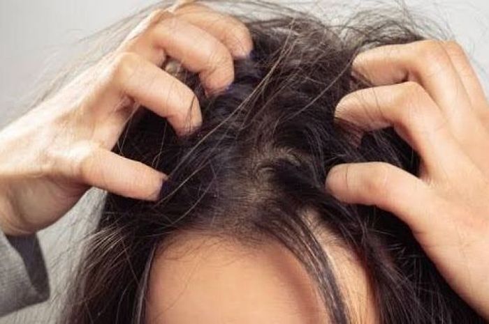 Rambut Putih, Bikin Gatal? Mitos atau Fakta?