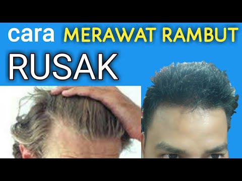 Rambut Bercabang: Musuh Sejati Pria Modern dan Solusi Mengatasinya