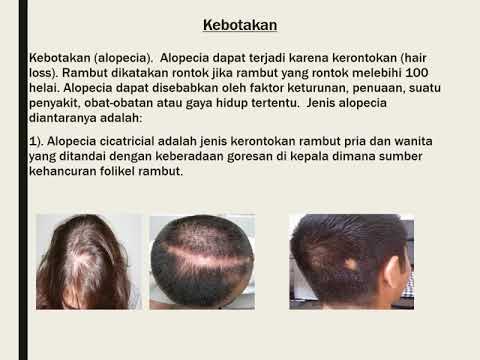 Kulit Kepala Gatal Hati-hati, Produk Rambut Bisa Jadi Biang Keladinya!