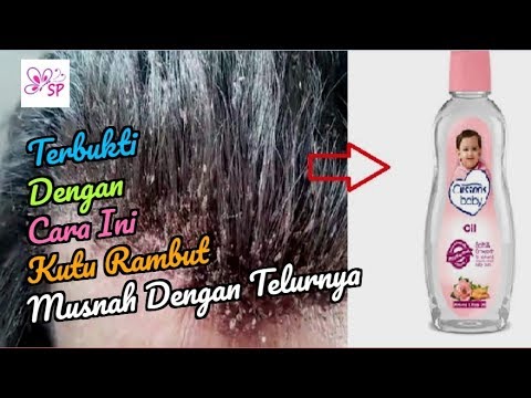 Menghilangkan Telur Kutu: Panduan Lengkap untuk Rambut Bebas Kutu