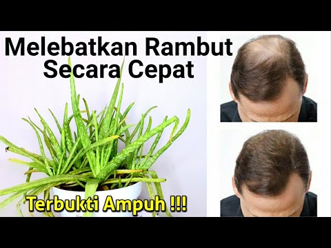 Rahasia Rambut Lebat dan Sehat: Panduan Lengkap Menuju Surai Impian