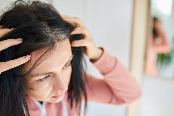 Rambut Lepek Usai Keramas? Tenang, Ada Solusinya!