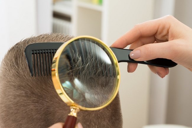 Ucapkan Selamat Tinggal pada Kutu Rambut dengan Minyak Almond!