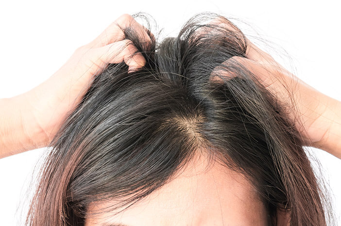 Hilangkan Kutu Rambut dengan Cuka: Cara Alami yang Ampuh dan Praktis!