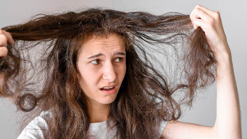 Rambut Kusut Masalah Usia Yang Tak Perlu Ditakutkan