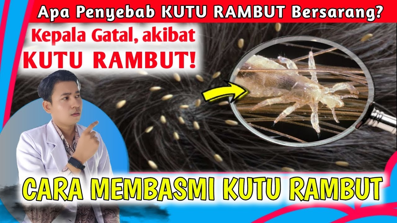 Atasi Kutu Rambut dengan Minyak Tea Tree: Cara Alami yang Efektif!