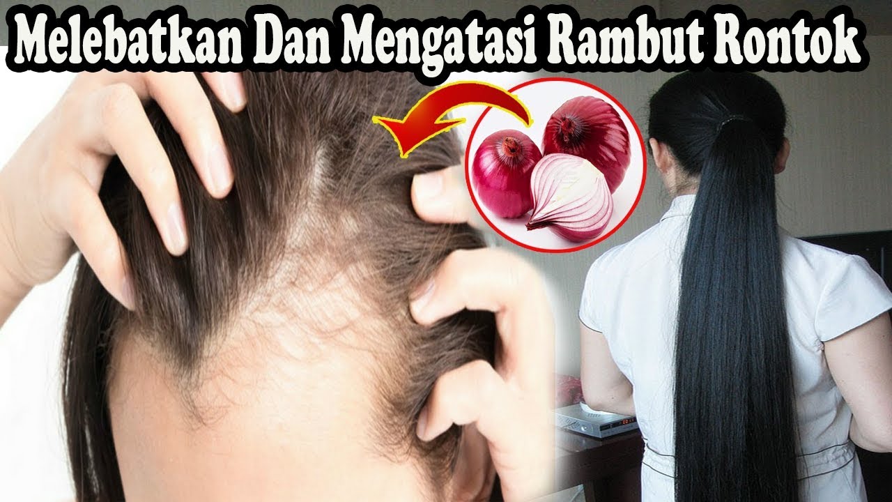 Rambut Rontok? Mungkin Anda Kekurangan Zat Besi!