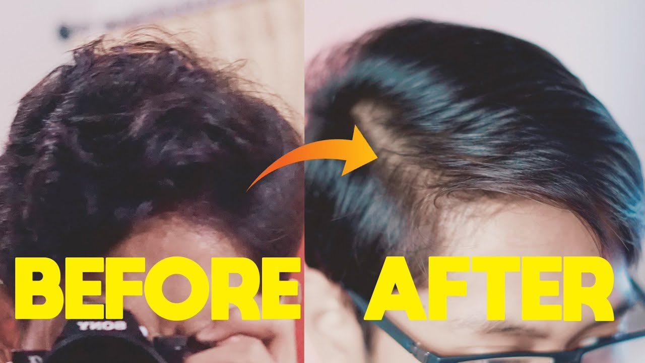 Mengapa Rambutku Mudah Patah Setelah Meluruskan Rambut?