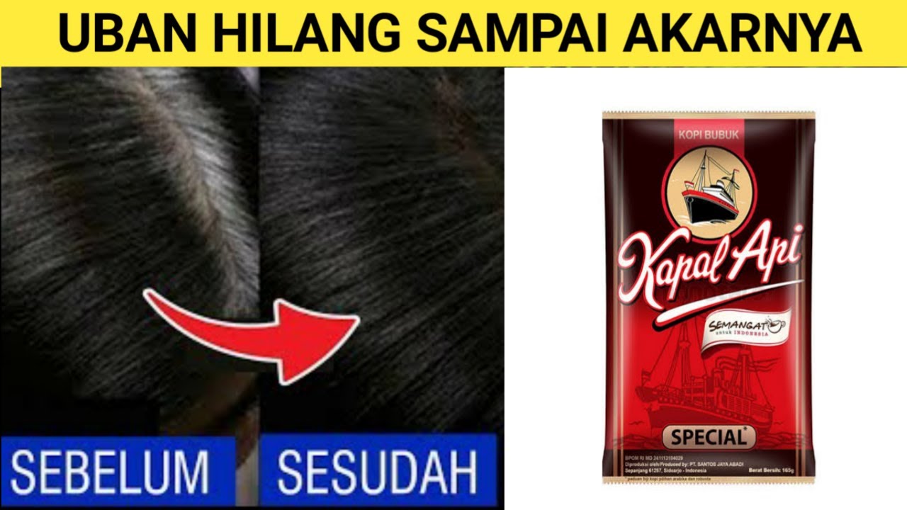 Merindukan Rambut Hitam Legam? Coba Metode Alami dan Produk Ini!