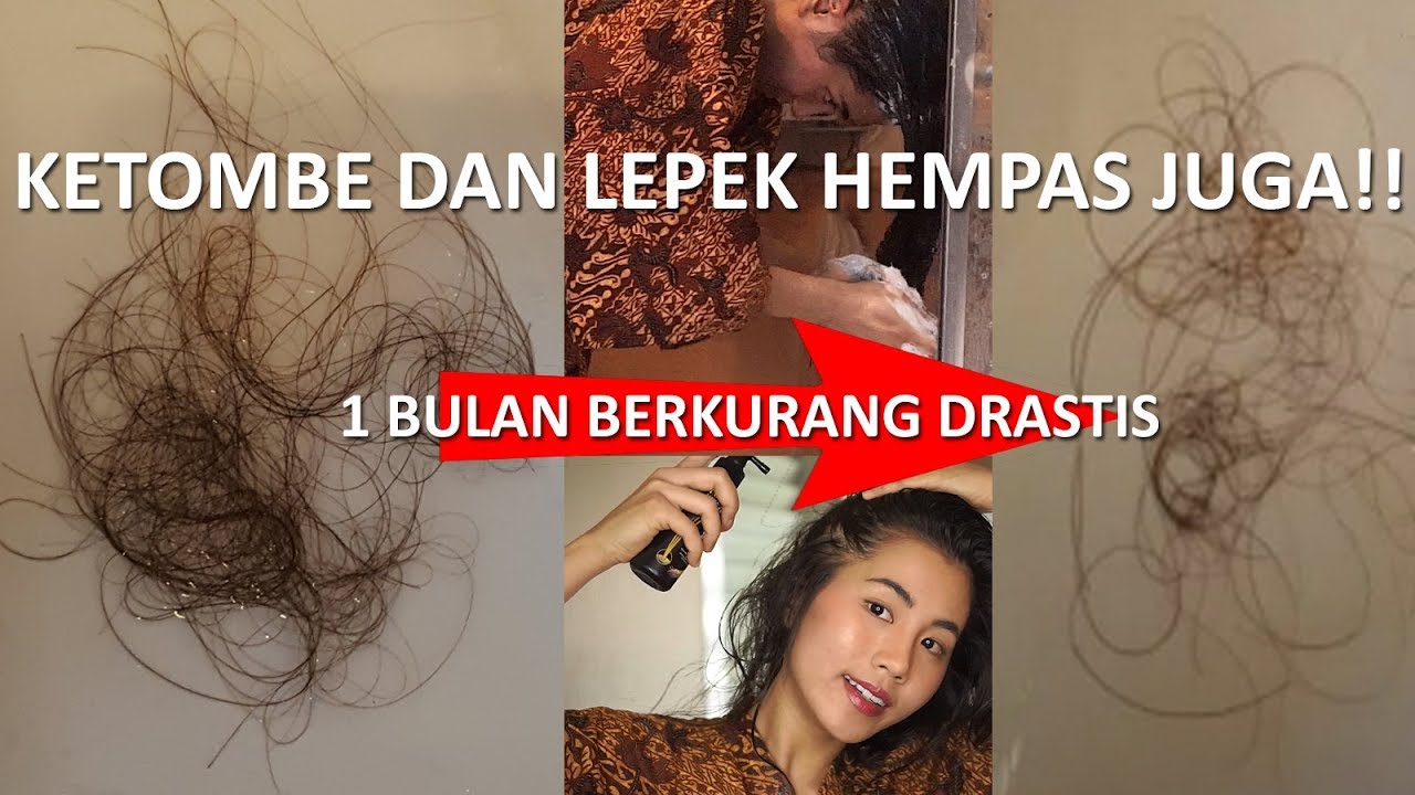 Rambut Rontok? Tenang, Ada Solusinya!