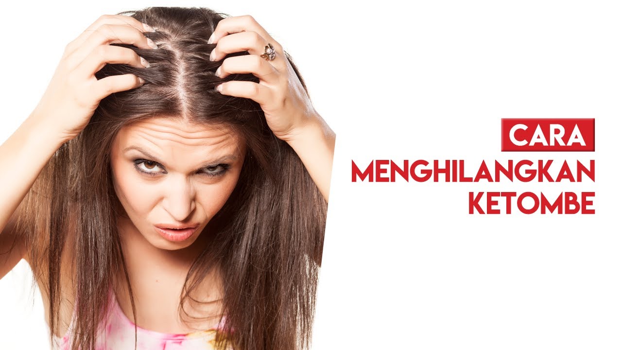 Rahasia Rambut Sehat dan Bebas Ketombe: Hilangkan Ketombe dengan Cepat dan Mudah!