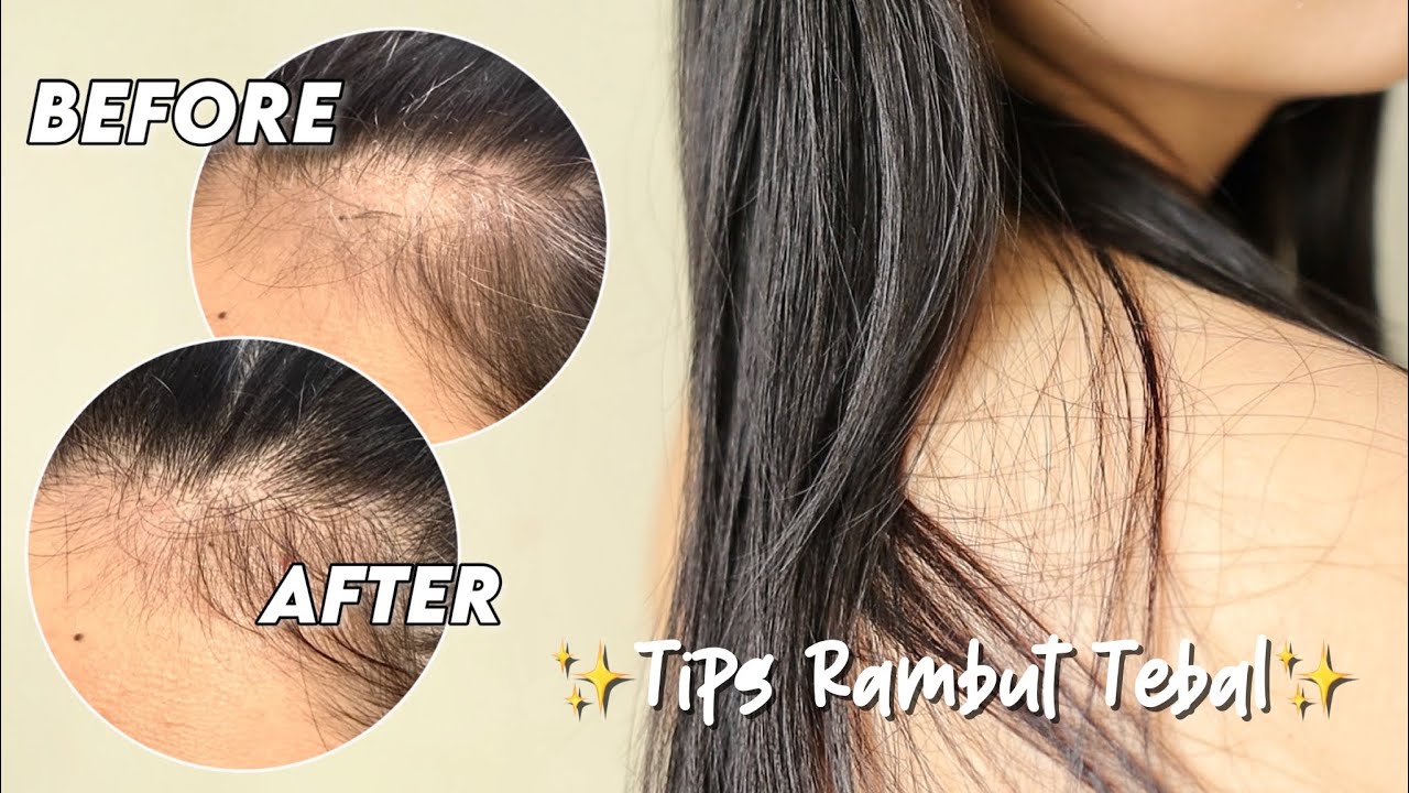 Cara Agar Rambut Tebal: Tips dan Trik untuk Menambah Kepadatan Rambut Anda