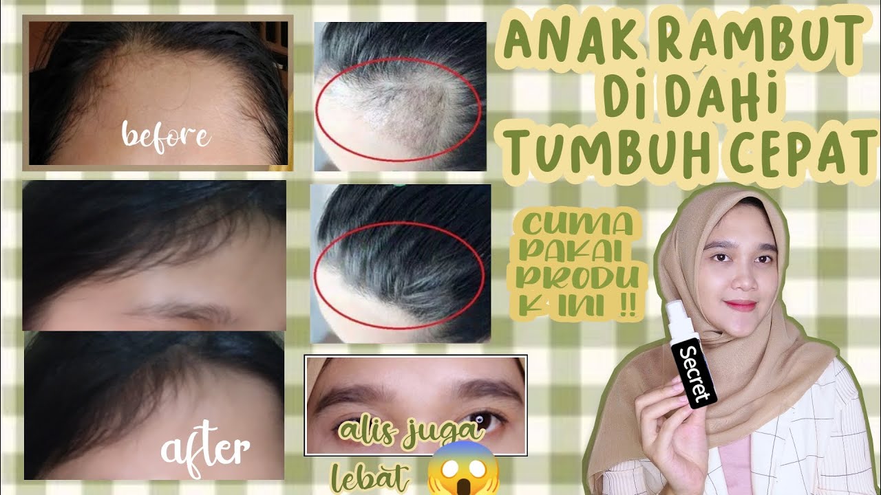 Cara Cepat Tumbuh Rambut: Teknik dan Produk untuk Mempercepat Pertumbuhan Rambut