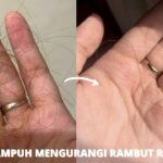 Rambut Rontok dan Tipis? Tenang, Ada Solusinya!