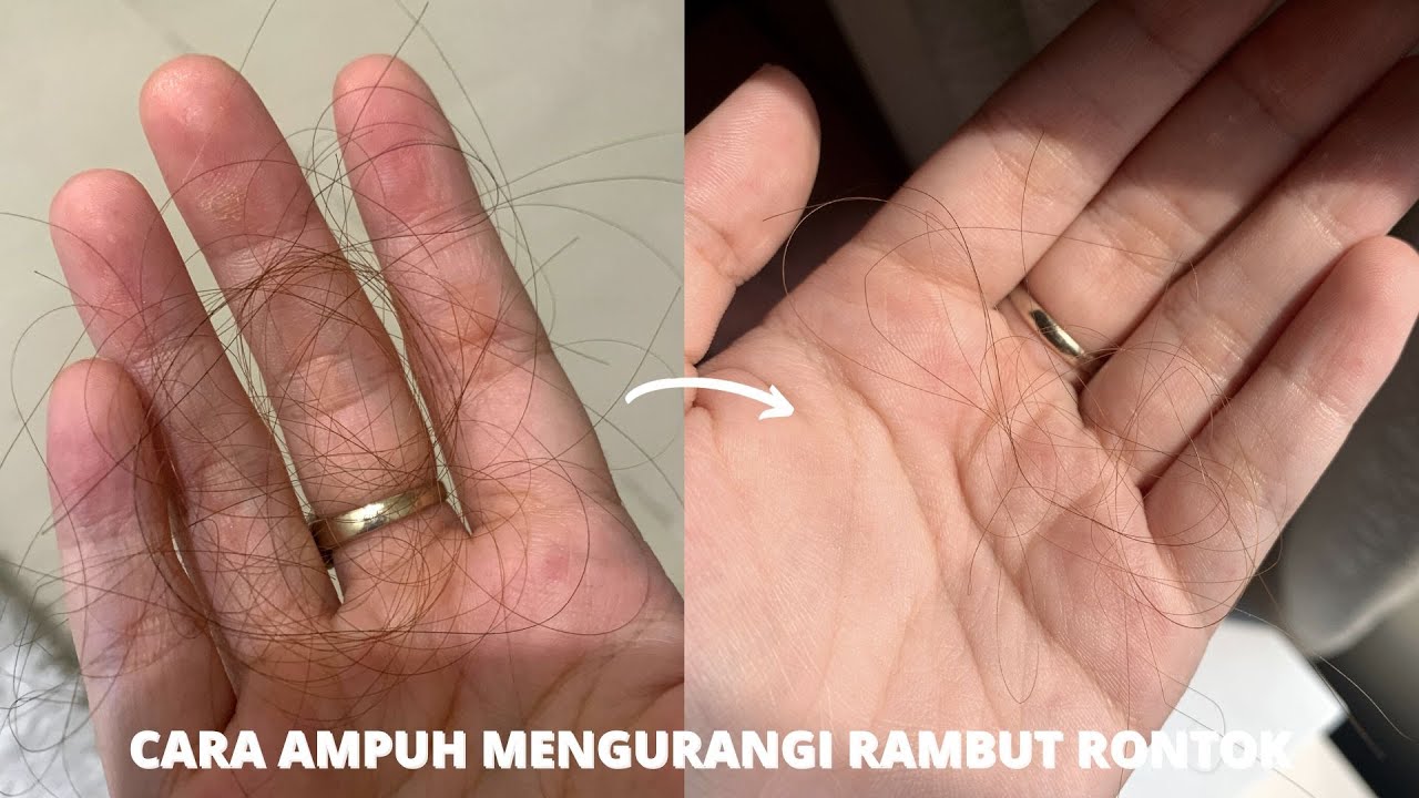 Rambut Rontok dan Tipis? Tenang, Ada Solusinya!