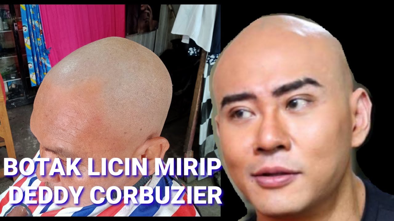 Rambut Botak Licin: Bisakah Kembali Tumbuh?