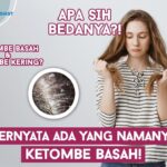 Bosan Dengan Ketombe Yang Membandel? Simak Panduan Lengkap Mengatasinya!