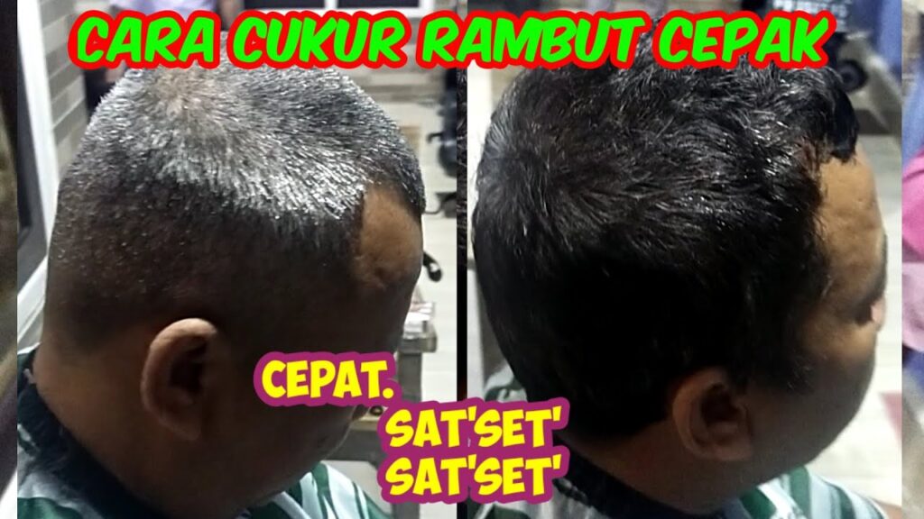 Rambut Bercepak Mekar? Tenang, Atasi dengan Tips Jitu Ini!