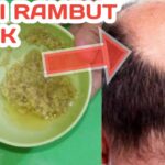 Rahasia di Balik Pertumbuhan Rambut: Perjalanan dari Folikel hingga Ujung Rambut