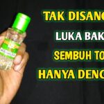 Luka Bakar dan Pitak: Mengapa Terjadi dan Bagaimana Mengatasinya?