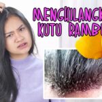 Atasi Kutu Rambut dengan Minyak Zaitun: Solusi Alami yang Efektif