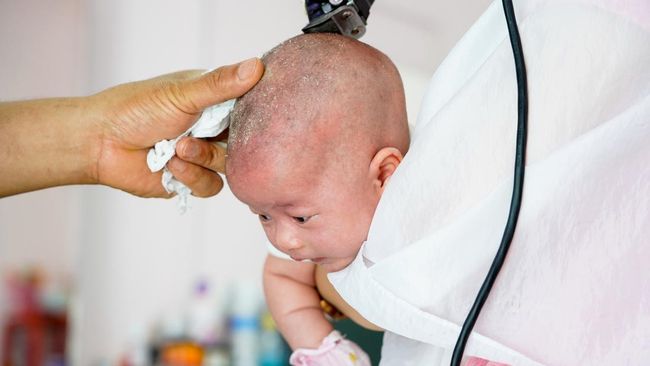 Mencukur Rambut Bayi: Tradisi, Hukum, dan Pandangan Islam