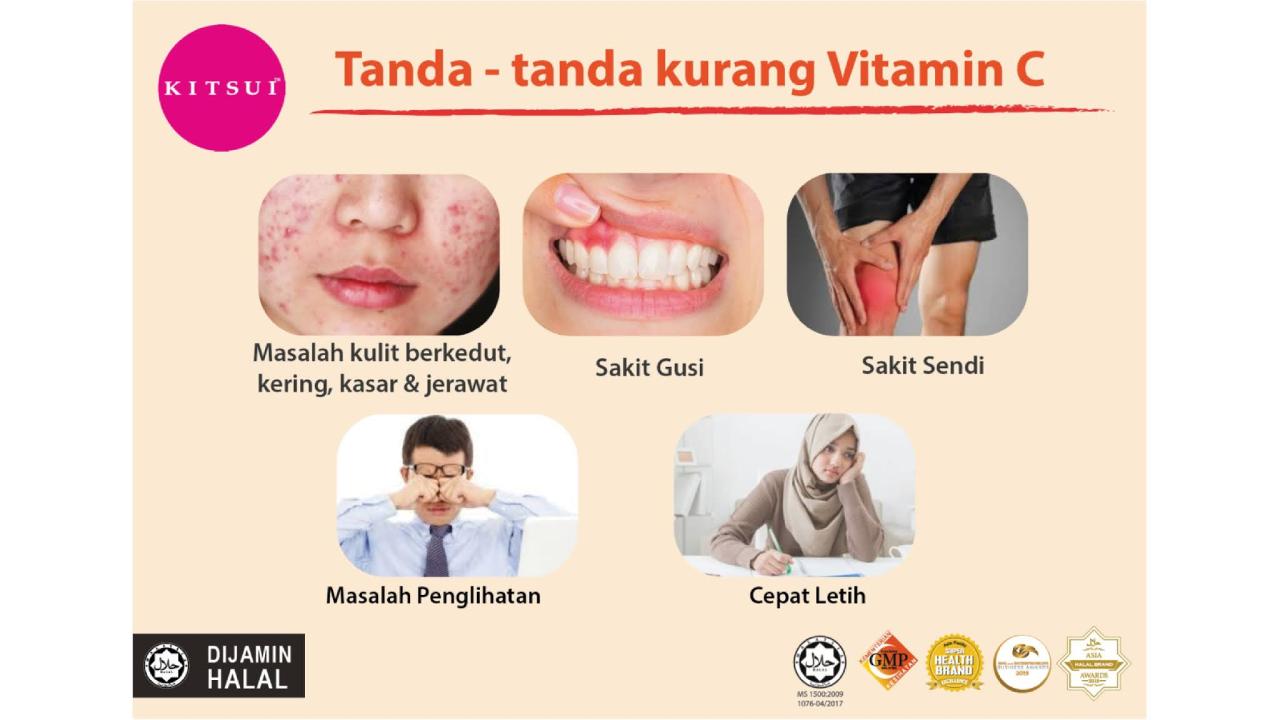 Pitak Menyerang? Mungkin Tubuhmu Kekurangan Vitamin!