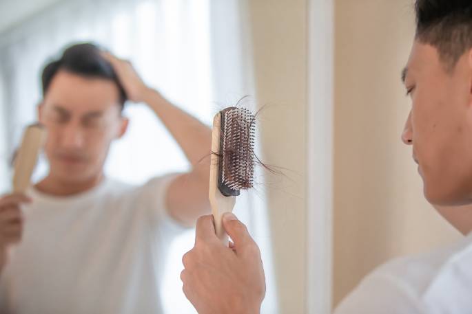 Rambut Rontok di Usia Muda: Kenapa Hal Ini Terjadi dan Bagaimana Mengatasinya?