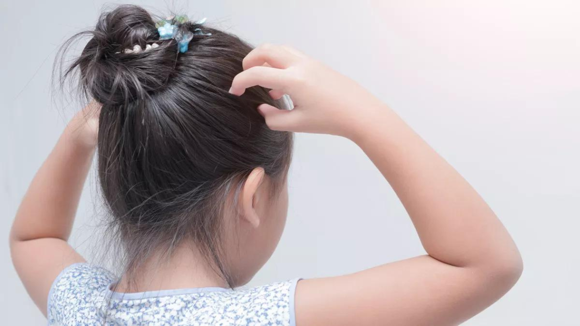 Rambut Anak Rontok? Tenang, Ini Solusinya!