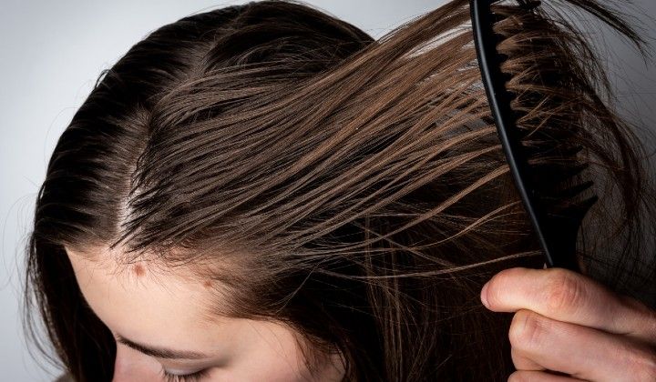 7 Langkah Mengatasi Rambut Berminyak Secara Efektif: Ucapkan Selamat Tinggal pada Rambut Lepek!